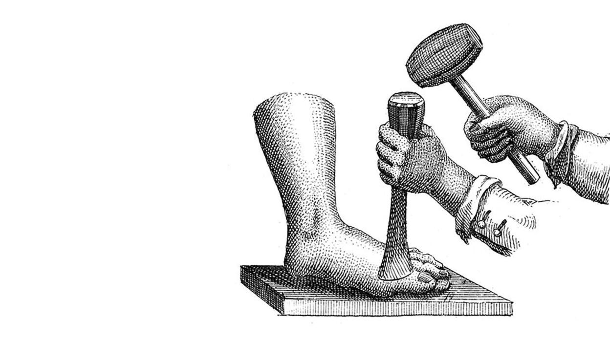 The Horrors of Surgery Before Energy