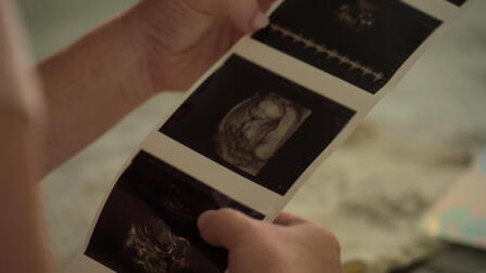 The Battle to Breathe: CF Before Birth
