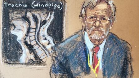 Medical expert says lack of oxygen caused Floyd’s death