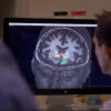 Ultrasound Brain Therapy for Addiction