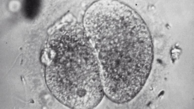 Chapter 1 | Test Tube Babies