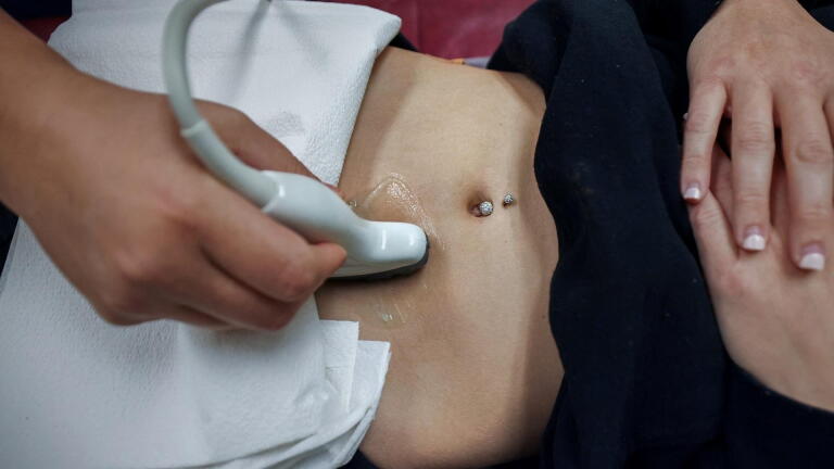 How state abortion bans are affecting doctors