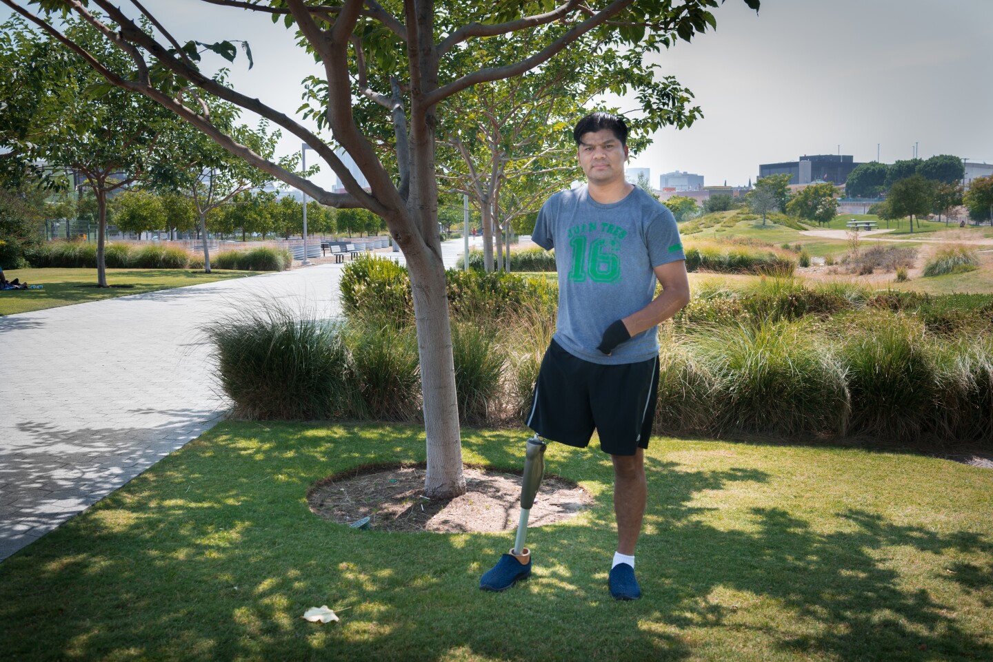 José Luis Hernández, from San José de los Guares, Honduras, lost two limbs and several fingers after he fell off a moving train known as La Bestia, or “the Beast,” which migrants use to travel across Mexico to the U.S. border.