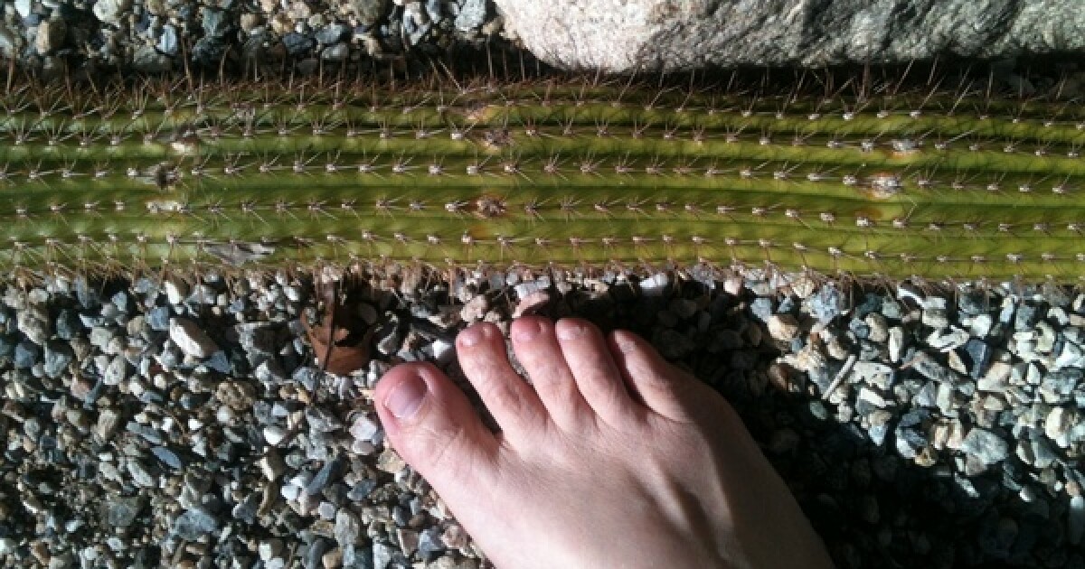 Why Do Cactus Needles Hurt: Uncover the Sharp Truth 6 Why Do Cactus Needles Hurt: Uncover the Sharp Truth