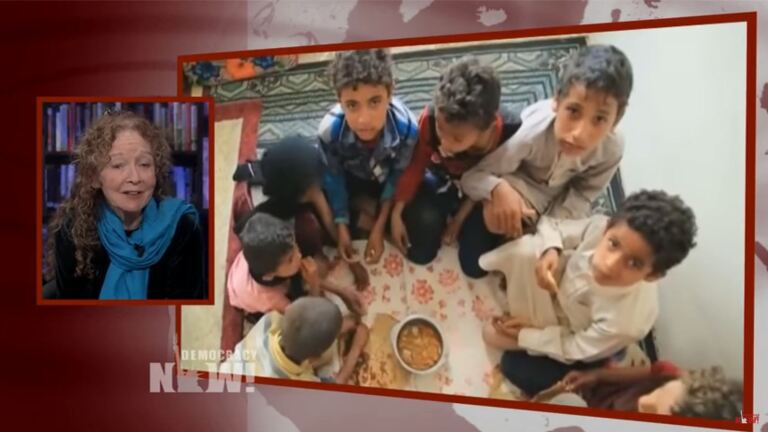 Yemenis Facing Bombings and Starvations