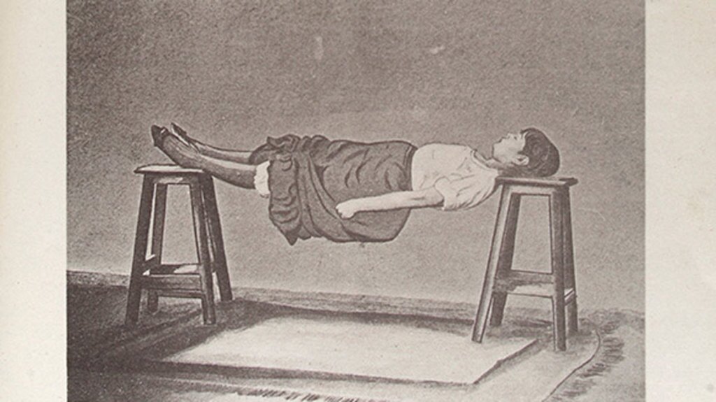 Spasms in hysterical patients | Wellcome Images Vireo