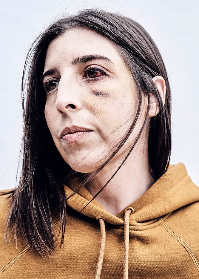 Rachel was shot with a rubber bullet to the head during the Black Lives Matter rally off Fairfax/Melrose near CBS Studios. | Shayan Asgharnia