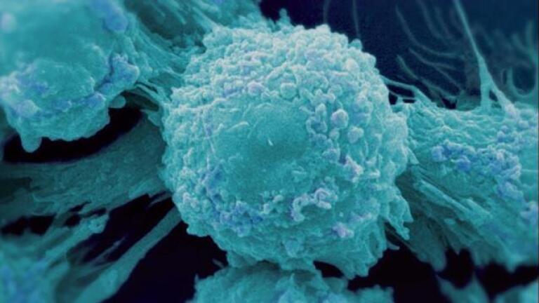 Why Cancer is so difficult to cure