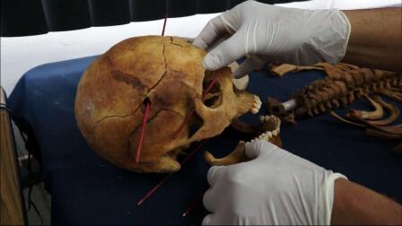 From Guatemalan, Scientists Unearth Signs of Genocide