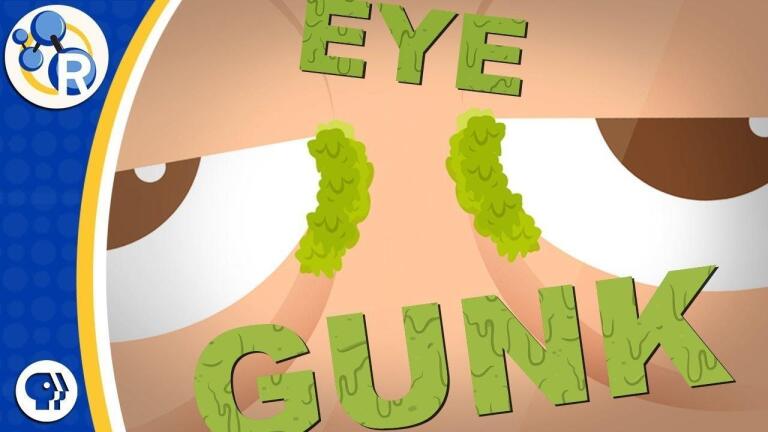 What are Eye Boogers?