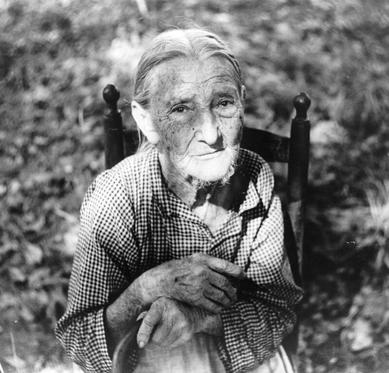 An elderly pellagra sufferer in Orange County, NC, ca. 1939.