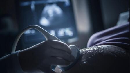 Why abortion opponents support Trump's Title X rule change