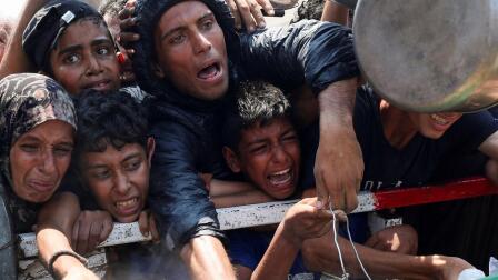 Aid worker in Gaza sees sharp rise in malnourished children