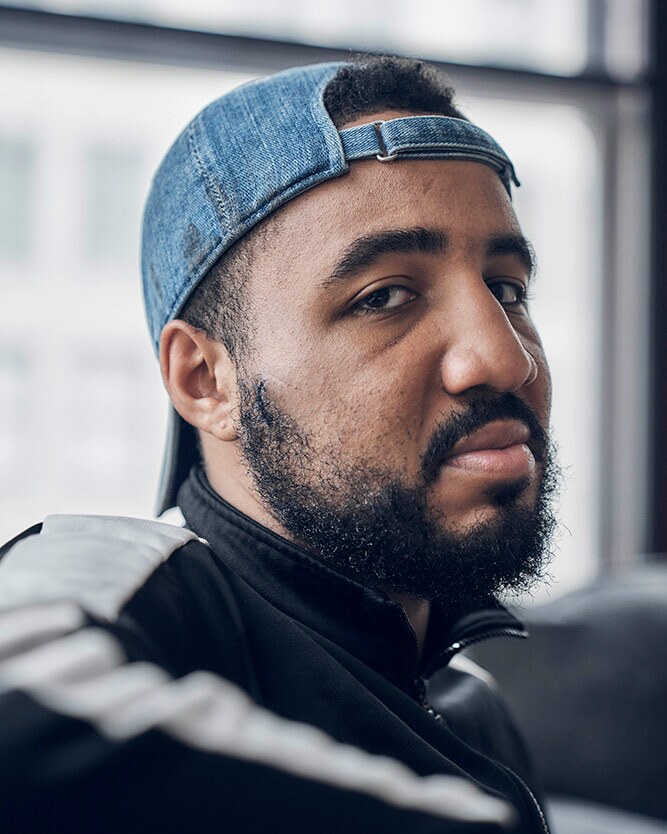 Deon Jones suffered two fractured bones in the back of his cheek and below his temple after police hit him with batons and shot him with rubber bullets. | Shayan Asgharnia
