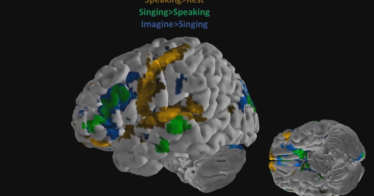 Singer Study Watch Geneticist and singer study how music can improve health | PBS ...