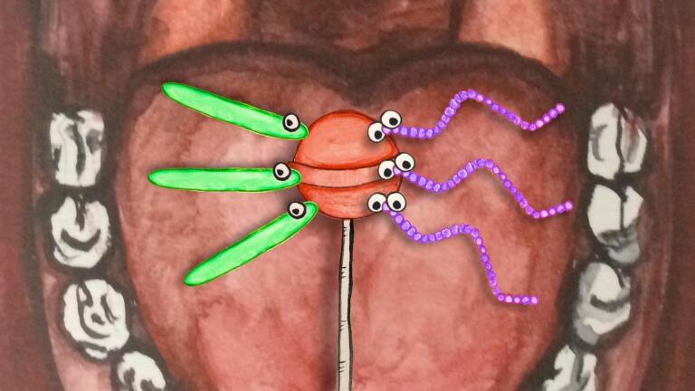 What Really Causes Cavities?