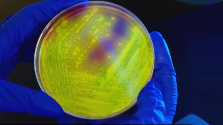 How overuse of antibiotics leads to drug-resistant superbugs