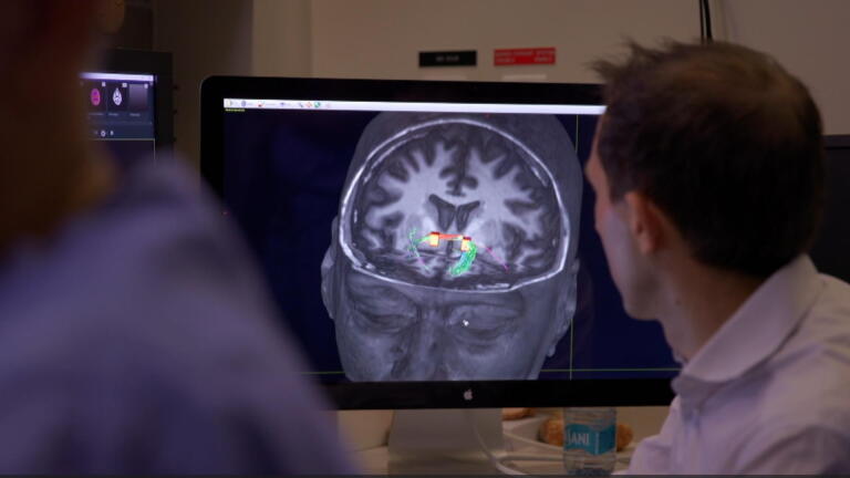 Ultrasound Brain Therapy for Addiction